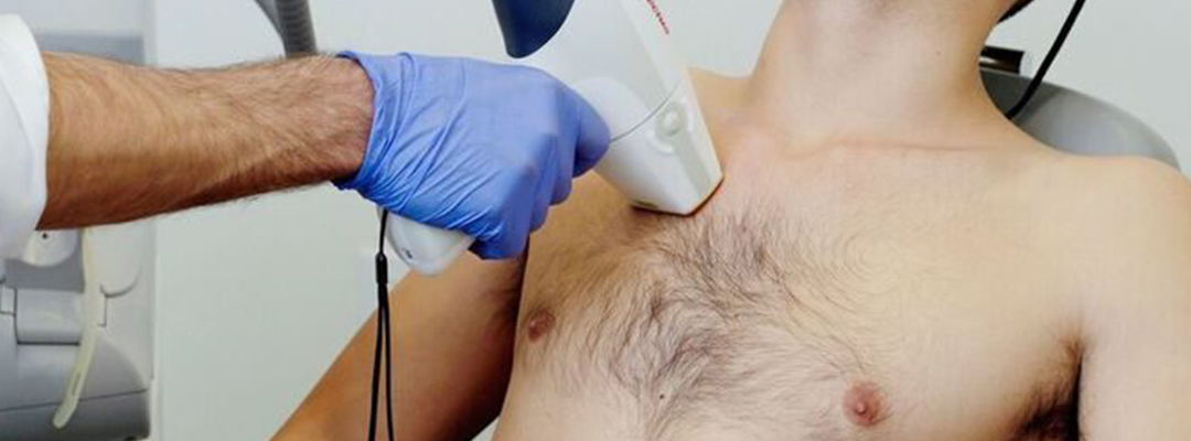 5 Lesser-Known Reasons Men Get Laser Hair Removal