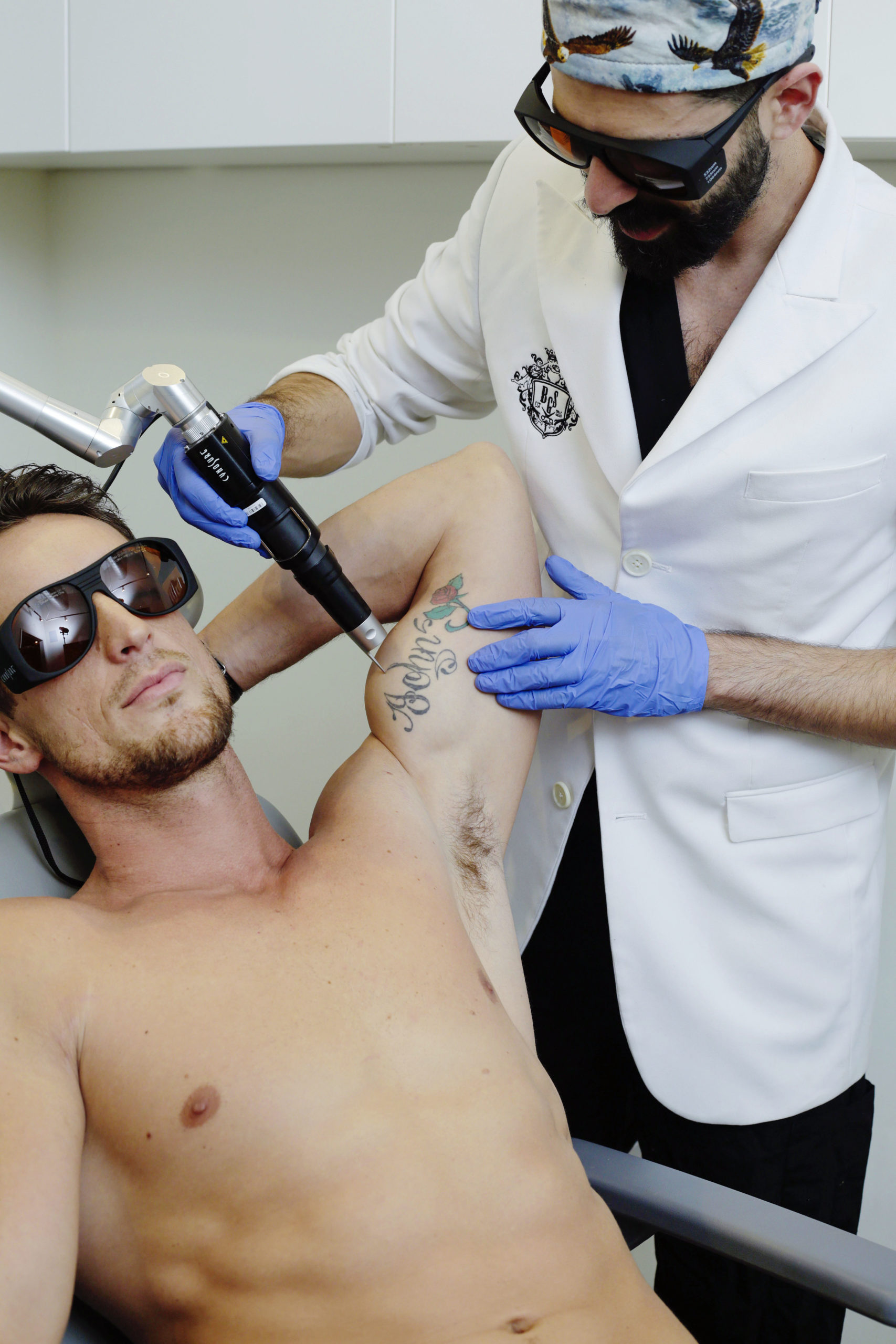 laser tattoo removal