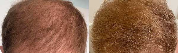 Before & After Combined Treatment
