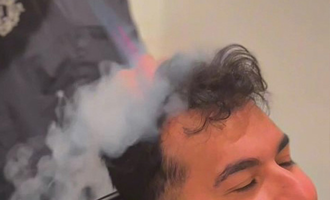 CryoStim Treatment