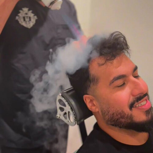 barbersurgeonsguild-cryostim-treatment-on-patient-500x500-1