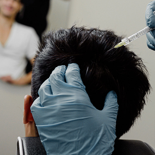 barbersurgeonsguild-exosomes-treatment-injection-500x500-1