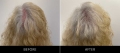 Scalp Camo Before & After Back