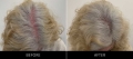 Scalp Camo Before & After Top