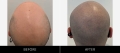 Scalp Camo Before & After Back